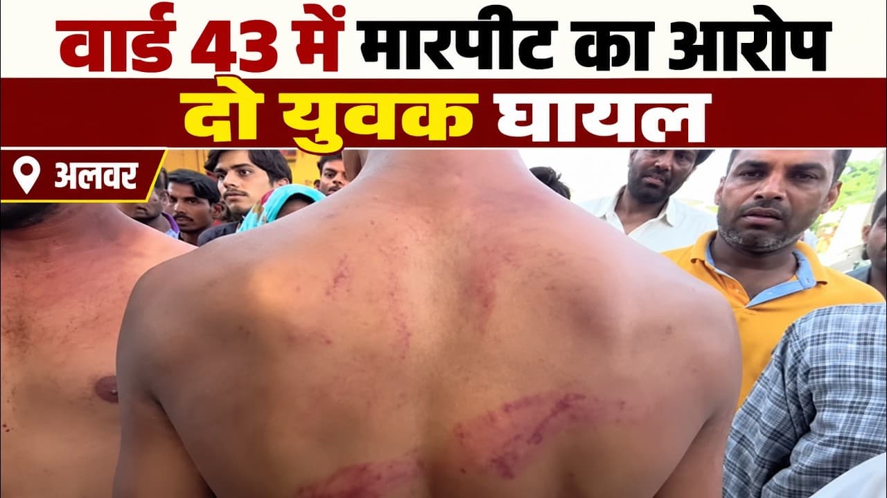Alwar News | नगर निगम चुनाव के बीच वार्ड 43 में मारपीट का आरोप | दो युवक घायल