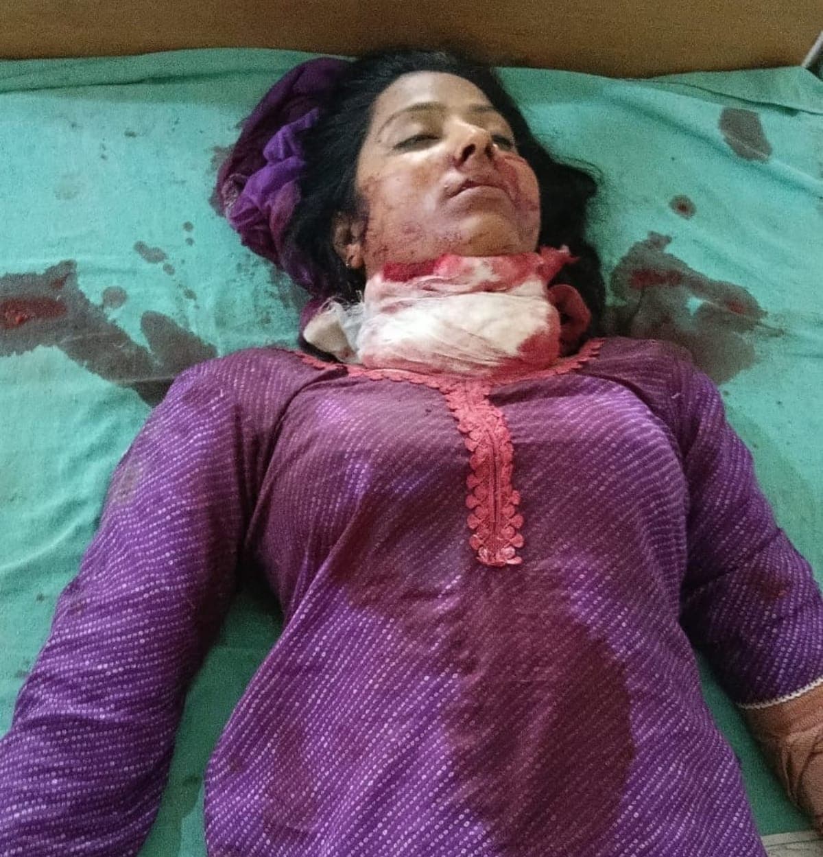 Panchkula News | पिंजौर में बुटीक संचालिका की हत्या : दुकान में गंभीर घायल मिली महिला | CCTV में दिखा संदिग्ध व्यक्ति