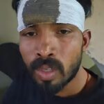 दूसरा पक्ष से घायल विकास कुमार, विकास का आरोप है कि उसे जानबूझकर निशाना बनाया गया 