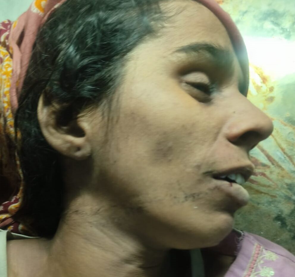 नूंह के डिढ़ारा गांव में दहेज के लिए विवाहिता की मौत