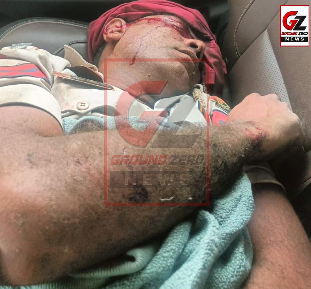 ईएचसी ओम प्रकाश गंभीर रूप से घायल