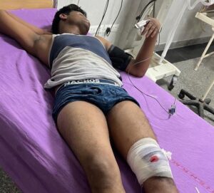 नूंह में पुलिस और गोतस्करों के बीच मुठभेड़, एक आरोपी घायल