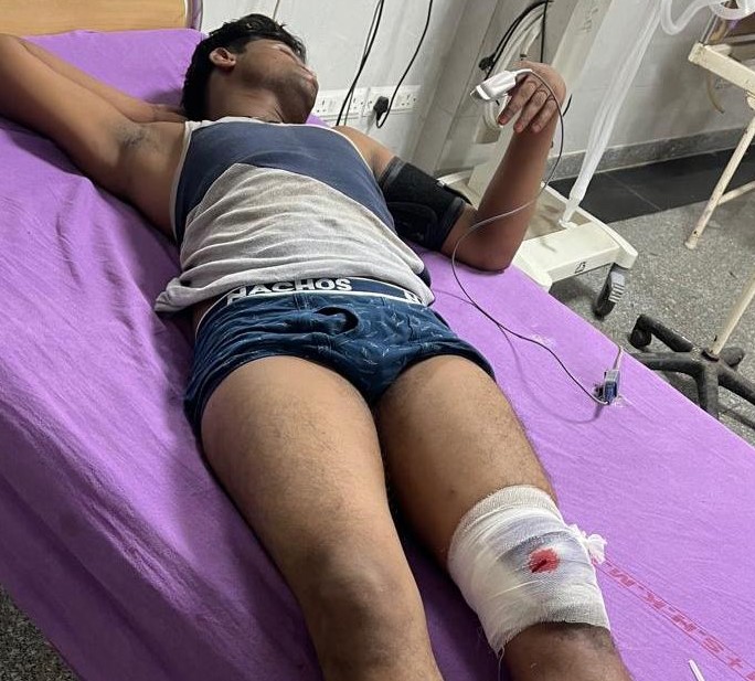नूंह में पुलिस और गोतस्करों के बीच मुठभेड़, एक आरोपी घायल